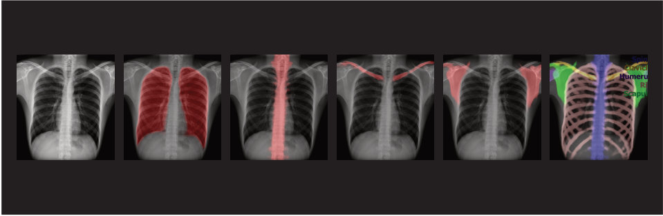 Photon-understanding AI semantic segmentation of a chest X-ray
