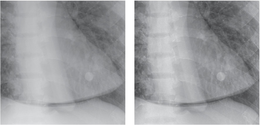Comparison of non-grid image and SBSC-processed image